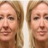 ♥{Retouches visage avec ce l