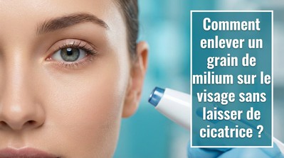 Guide complet 2026 : &Eacute;liminer les grains de milium sans cicatrice
