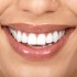» Le sourire
