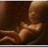 L’évolution d’un bébé d
