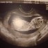 Mon futur bébé