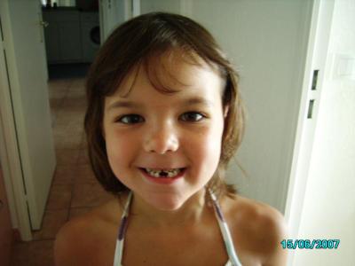 ma fille avec 2 dents en moins